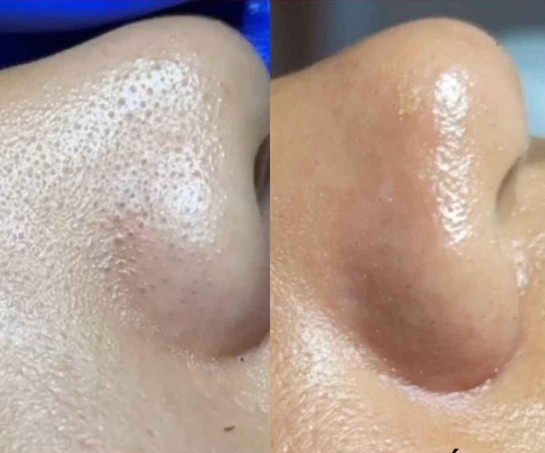 Deep Cleansing