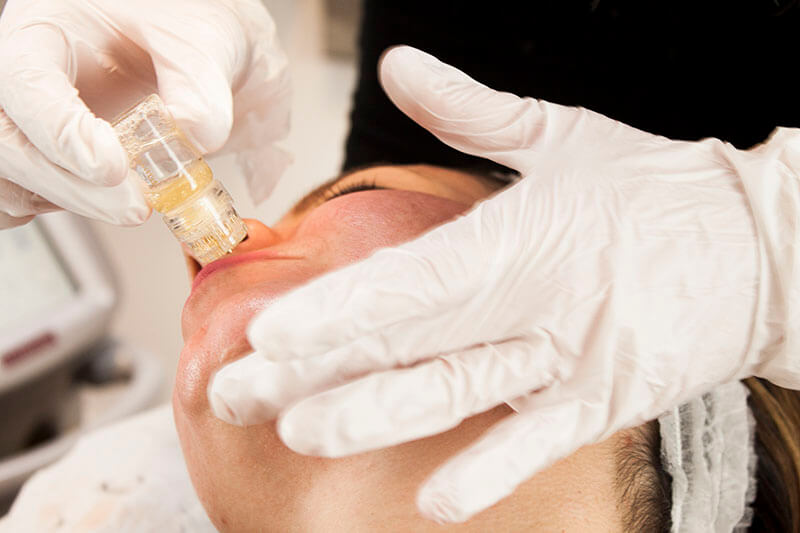 Facial Aquagold Baby Botox