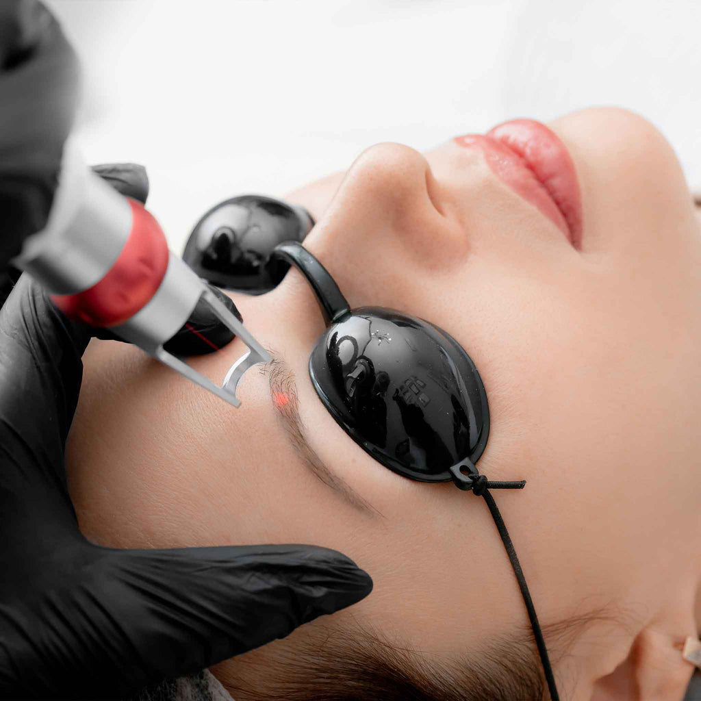 Tattoo Removal in Eyebrows &amp; Unwanted Micropigmentation 